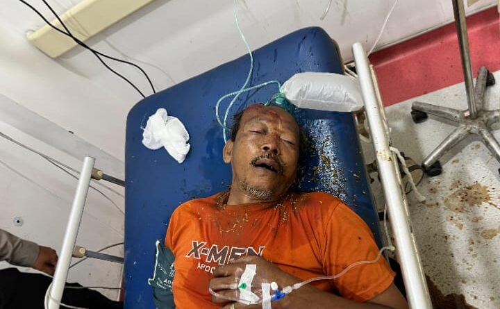Pria Tanpa Identitas Tak Sadarkan Diri Usai Kecelakaan di Tambakrejo Kraton, Kini Dirawat di RSUD Bangil